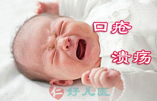小儿口疮溃疡.jpg 小儿口疮溃疡.jpg